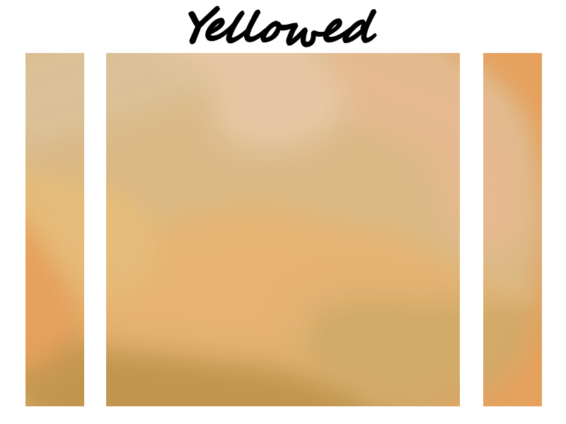 Yellowed Skin